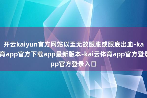 开云kaiyun官方网站以至无故眼胀或眼底出血-kai云体育app官方下载app最新版本-kai云体育app官方登录入口